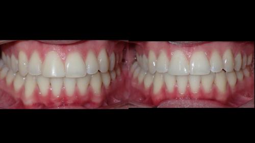 large-Diapositiva14